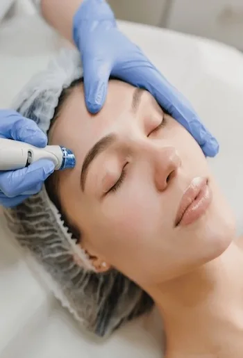 microdermabrasion
