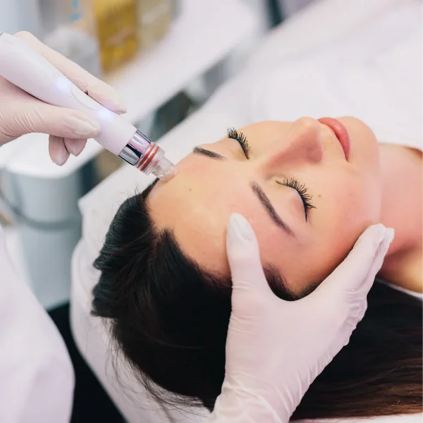 Patient receiving professional aesthetic treatment with micro needling device at dermatology clinic