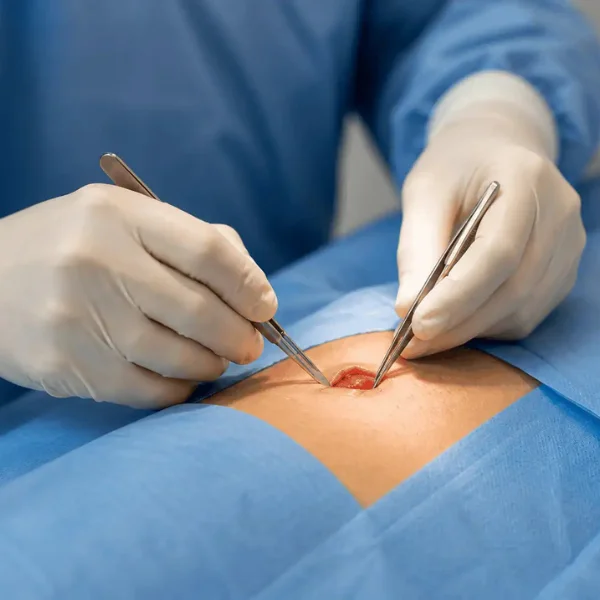 surgical dermatology services